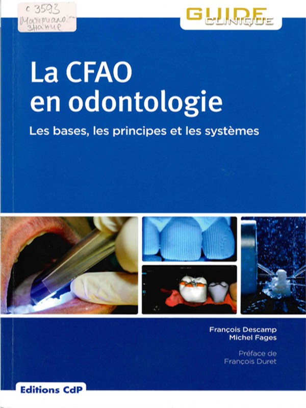 La CFAO en odontologie