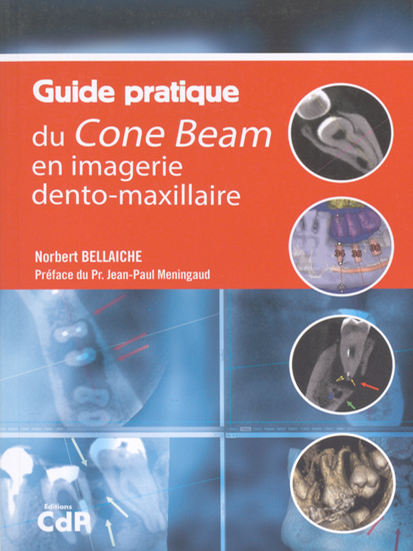 Guide pratique du Cone Beam