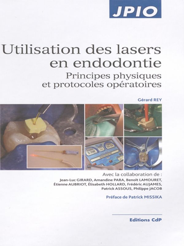 Utilisation des lasers en endodontie