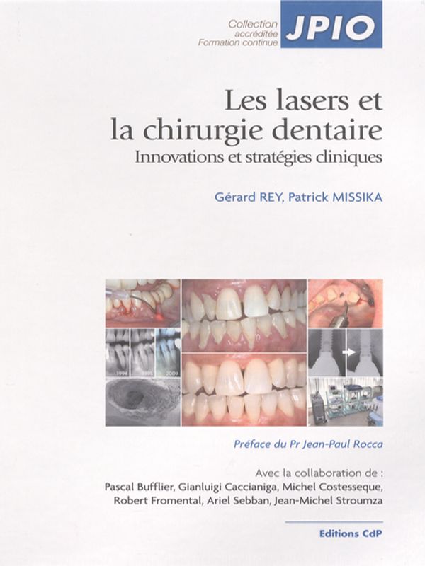 Les lasers et la chirurgie dentaire