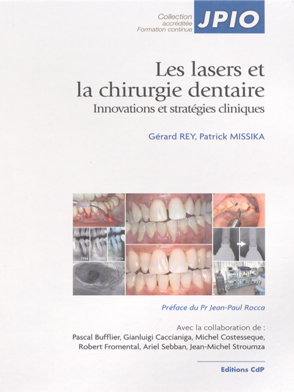 Les lasers et la chirurgie dentaire