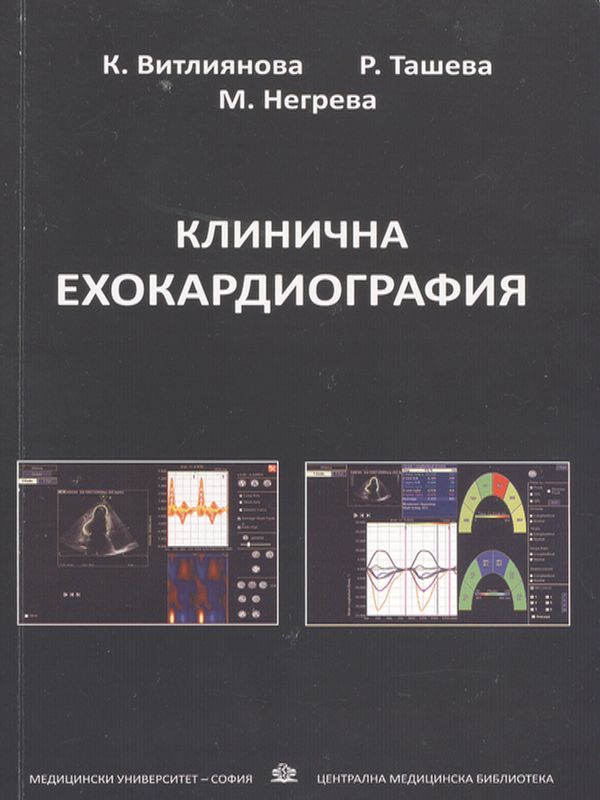 Клинична ехокардиография