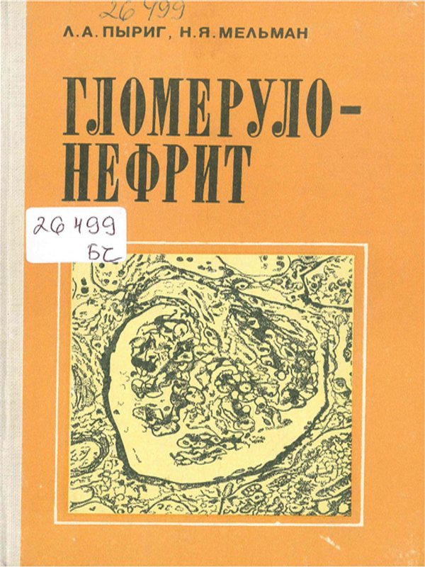 Гломерулонефрит