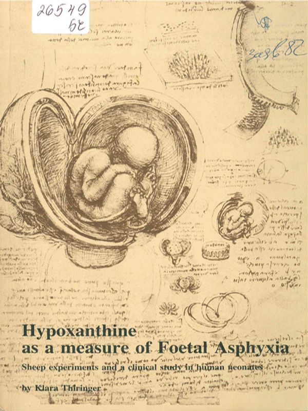 Hypoxanthine as a measure of foetal asphyxia
