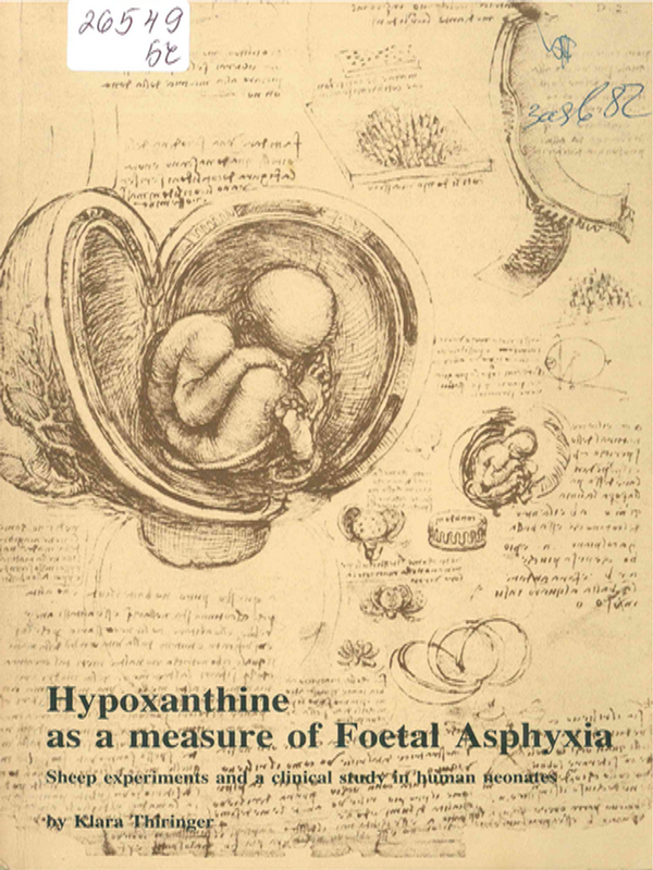 Hypoxanthine as a measure of foetal asphyxia
