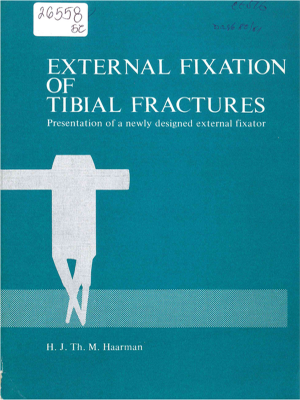 External fixation of tibial fractures