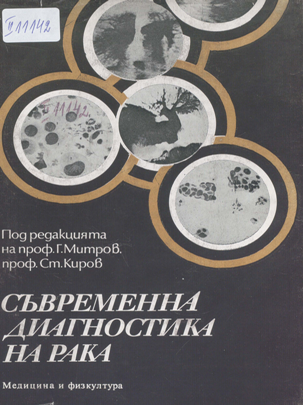 Съвременна диагностика на рака