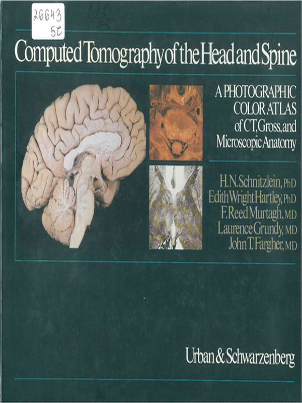 Computed tomography of the head and spine