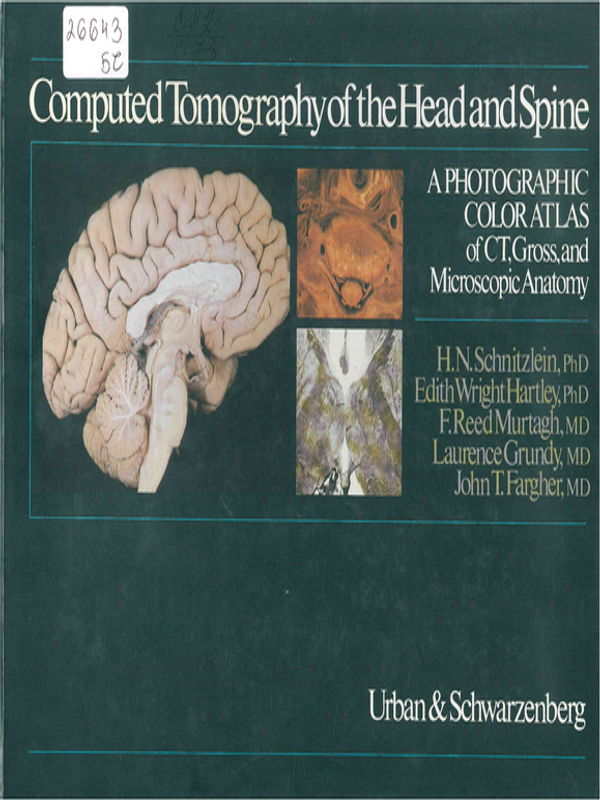 Computed tomography of the head and spine