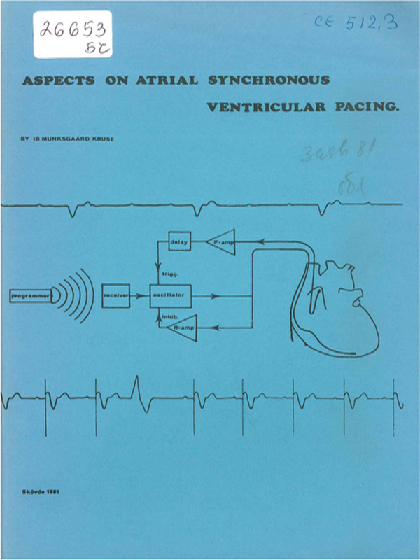 Aspects on atrial synchronous ventricular pacing