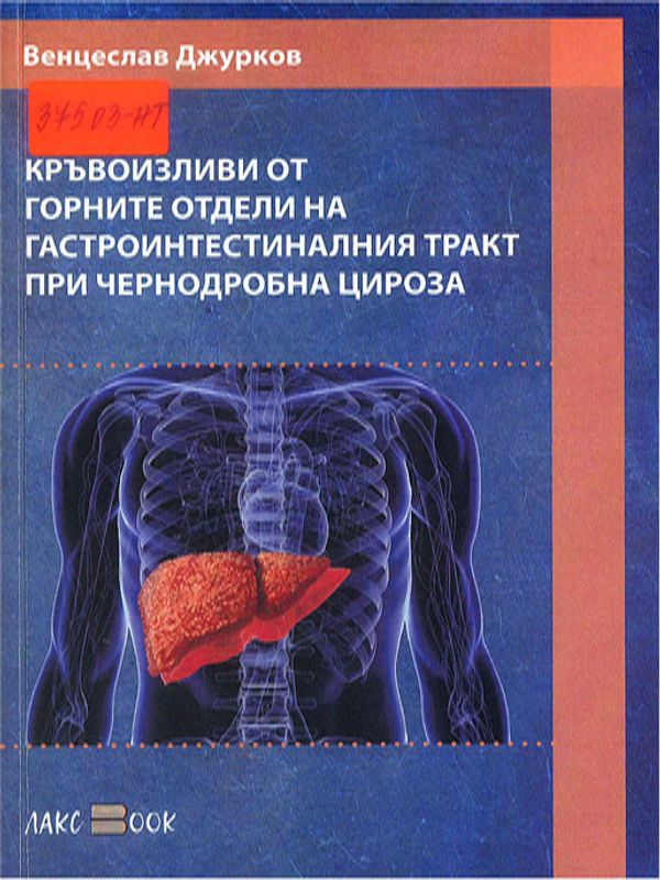 Кръвоизливи от горните отдели на гастроинтестиналния тракт при чернодробна цироза