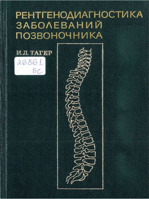 Рентгенодиагностика заболеваний позвоночника