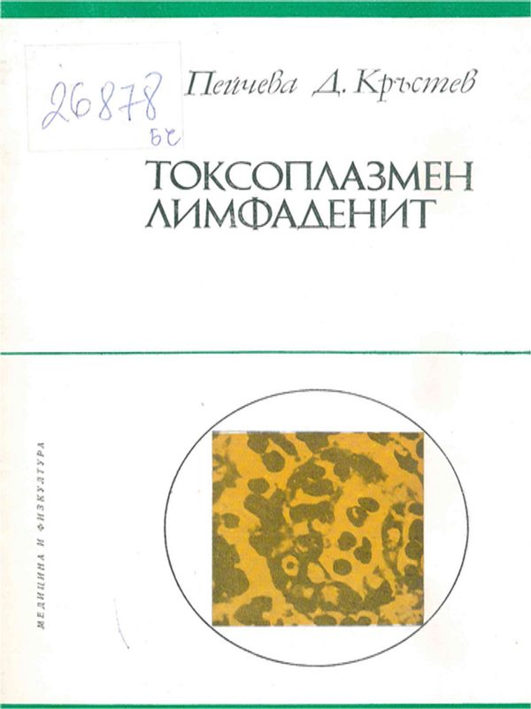 Токсоплазмен лимфаденит