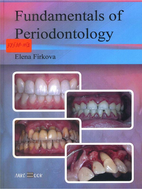 Fundamentals of periodontology