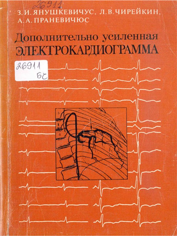 Дополнительно усиленная электрокардиограмма