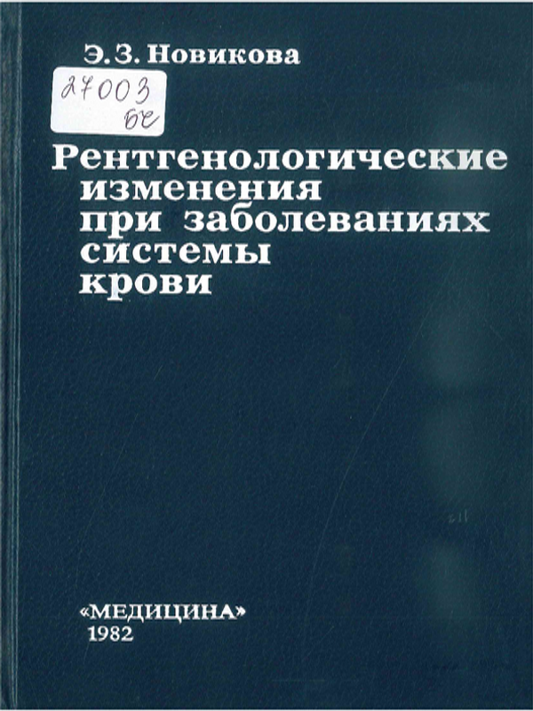 Рентгенологические изменения при заболеваниях системы крови
