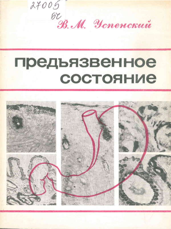 Предьязвенное состояние