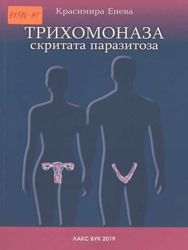 Трихомоназа скритата паразитоза