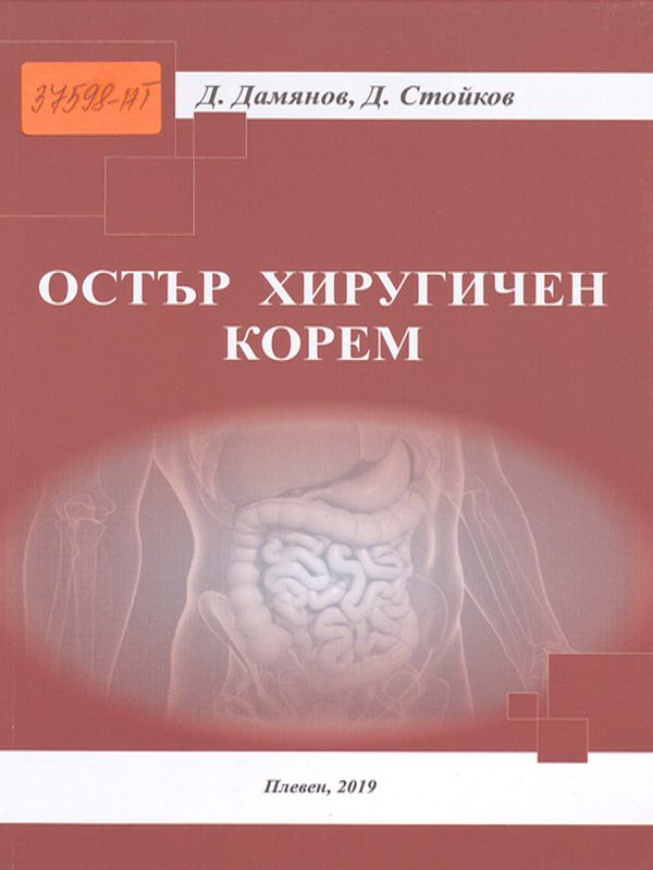 Остър хирургичен корем