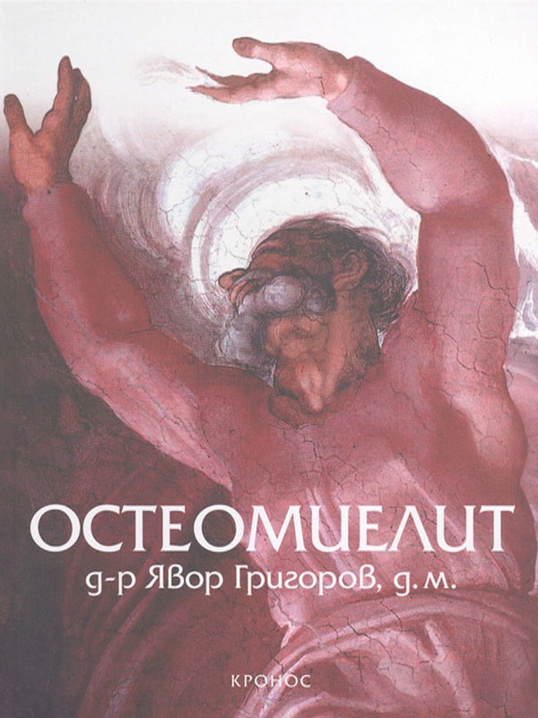 Остеомиелит