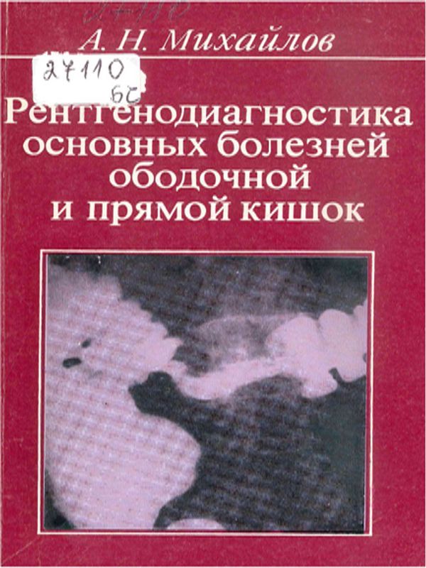 Рентгенодиагностика основных болезней ободочной и прямой кишок