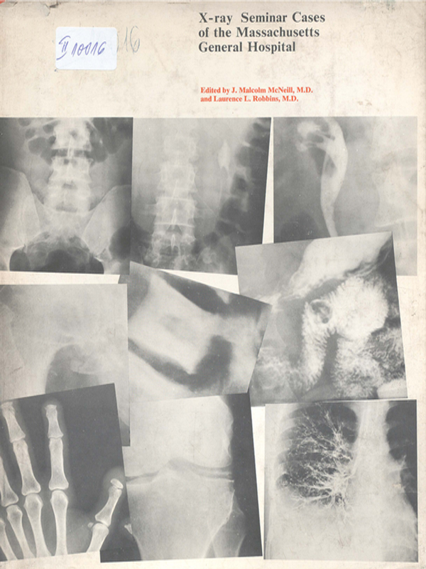 X-ray seminar cases of the Massachussetts general hospital