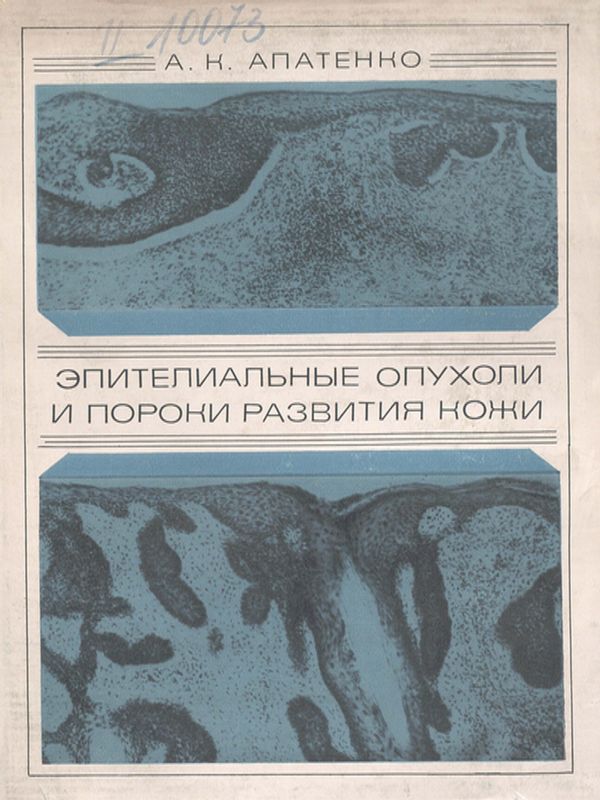 Эпителиальные опухоли и пороки развития кожи