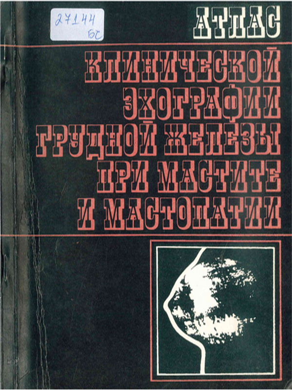 Атлас клинической эхографии грудной железы при мастите и мастопатии