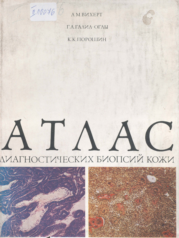 Атлас диагностических биопсий кожи