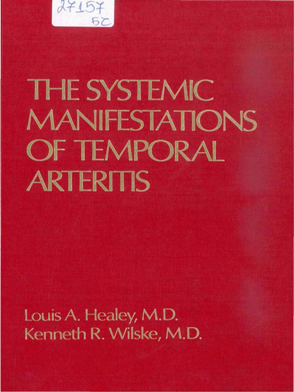 The systemic manifestations of temporal arteritis