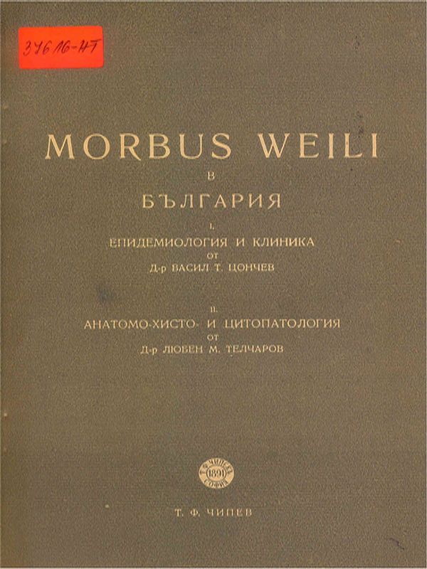 Morbus Weili