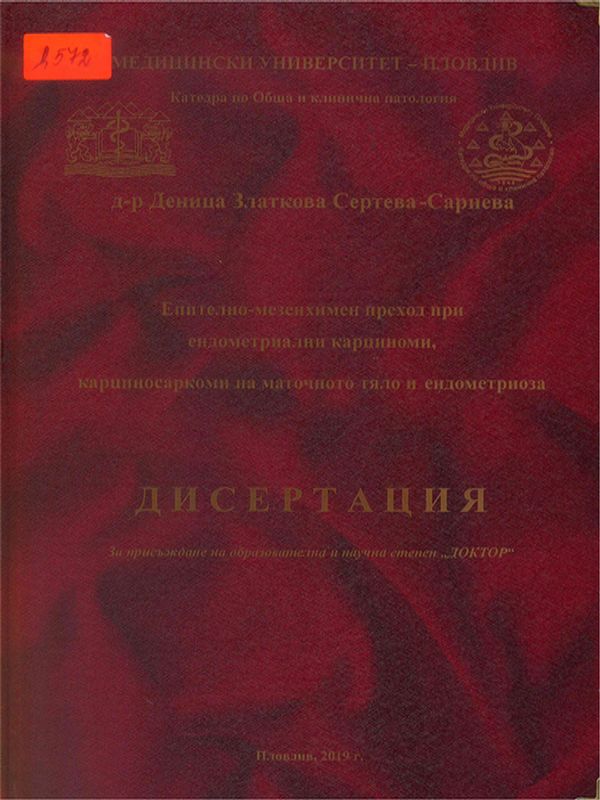 Епително-мезенхимен преход при ендометриални карциноми, карциносаркоми на маточното тяло и ендометриоза