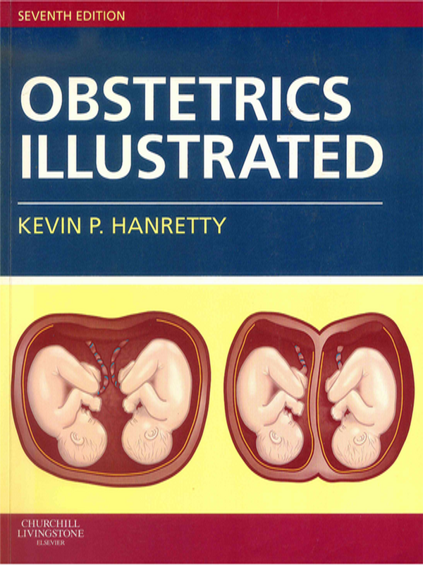Obstetrics illustrated