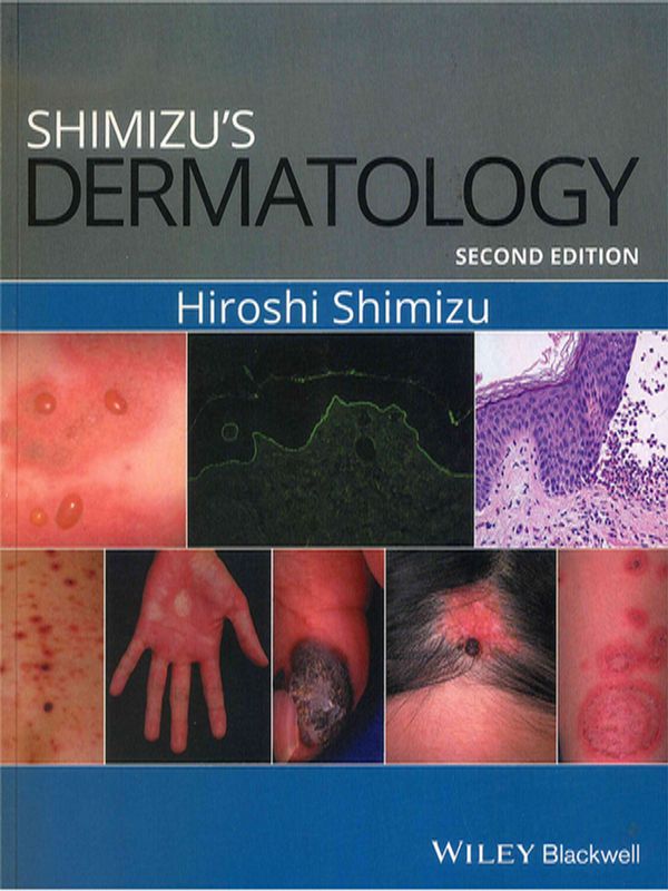 Shimizu`s dermatology