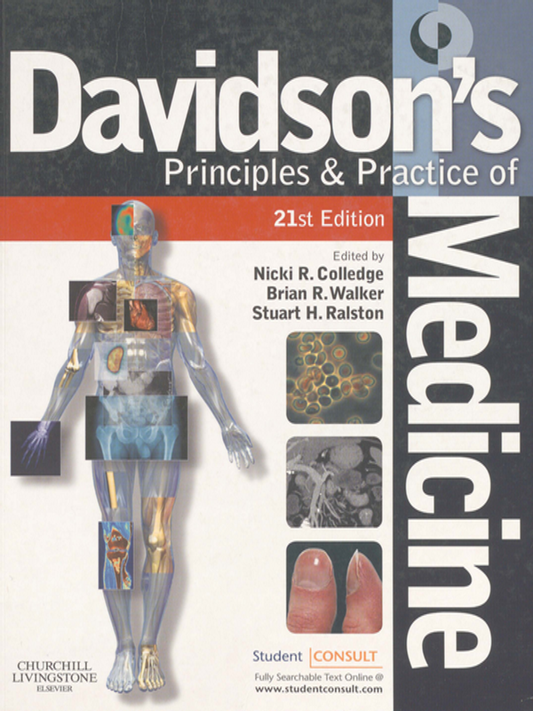 Davidson`s principles and practice of medicine