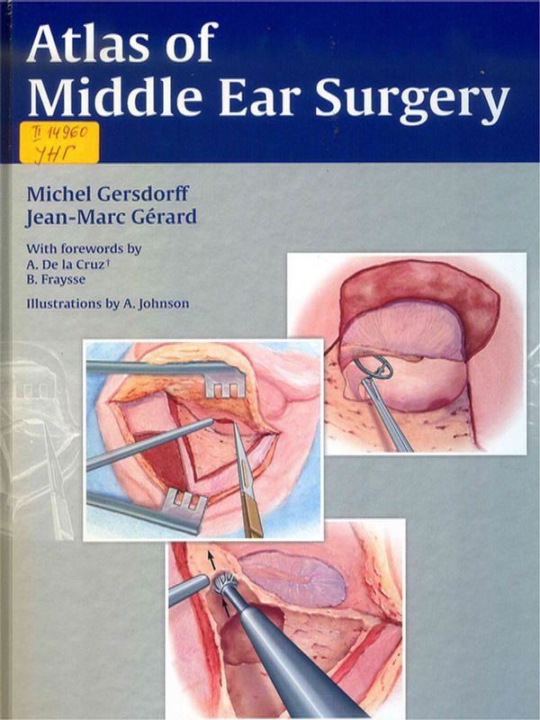 Atlas of middle ear surgery