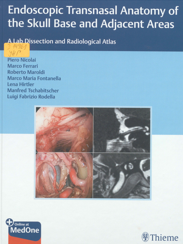 Endoscopic transnasal anatomy of the skull base and adjacent areas