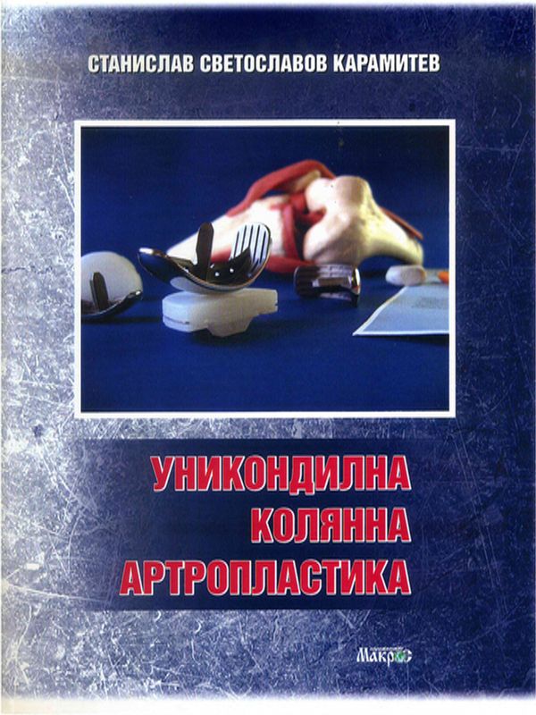 Уникондилна колянна артропластика