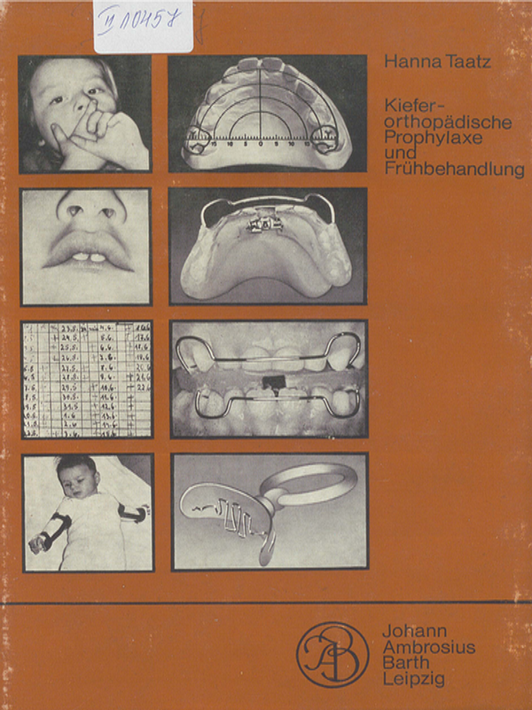 Kieferorthopadische Prophylaxe und Fruhbehandlung