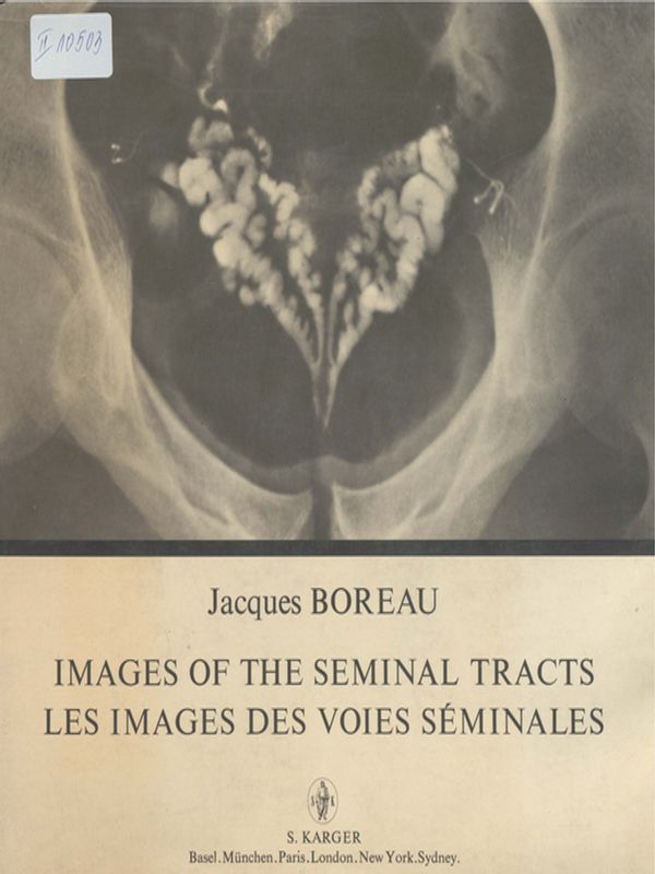 Images of the Seminal Tracts