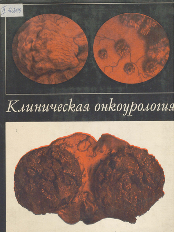 Клиническая онкоурология