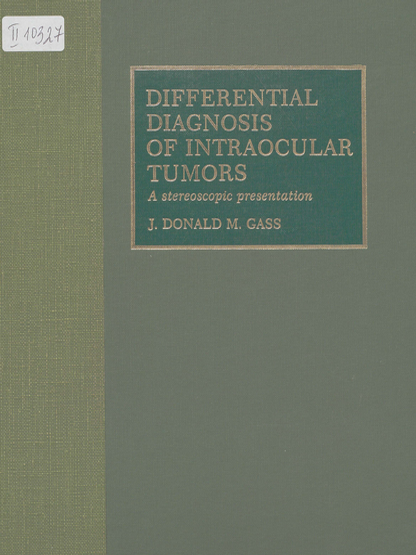 Differential diagnosis of intraocular tumors