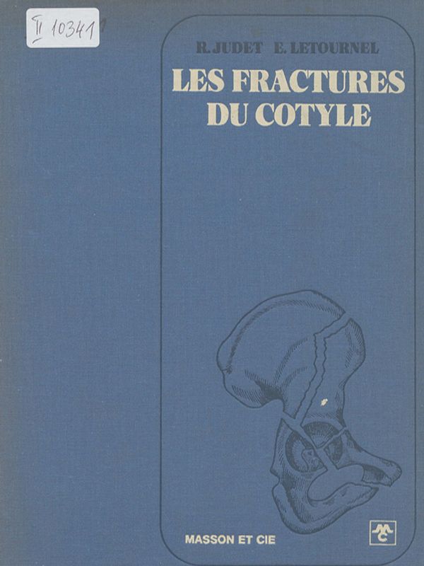Les fractures du cotyle