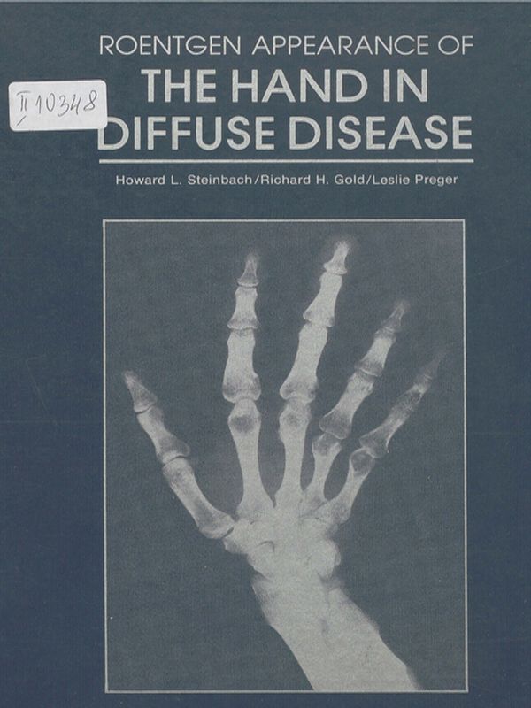 Roentgen appearance of the hand in diffuse disease