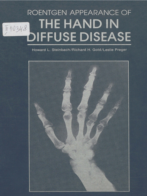 Roentgen appearance of the hand in diffuse disease