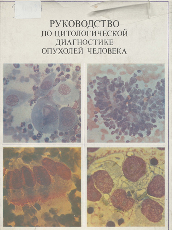 Руководство по цитологической диагностике опухолей человека