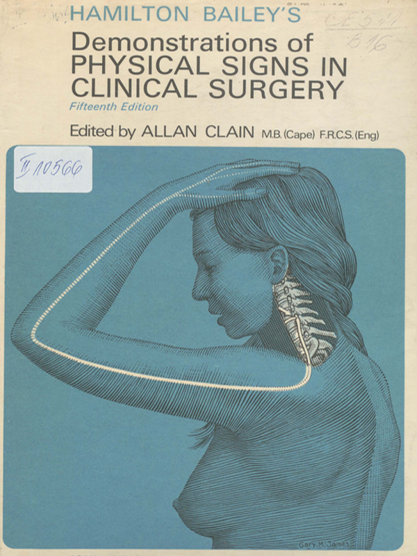 Hamilton Bailey`s Demonstrations of Physical Signs in Clinical Surgery