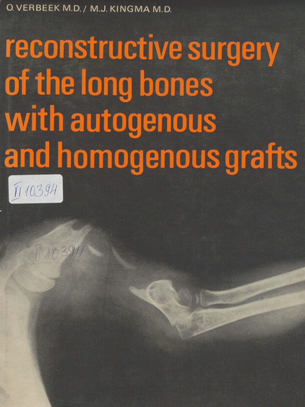 Reconstructive surgery of the long bones with autogenous and homogenous grafts