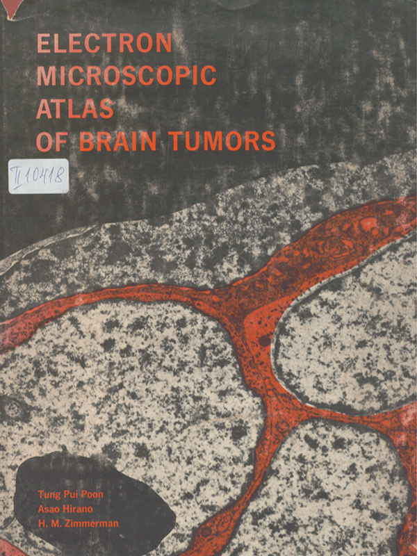 Electron microscopic atlas of brain tumors