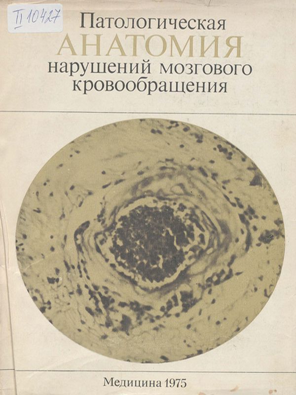 Патологическая анатомия нарушений мозгового кровообращения